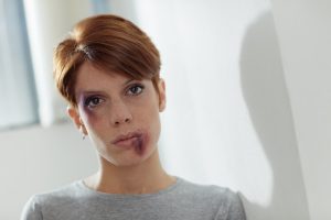 Photo of beaten young Caucasian woman