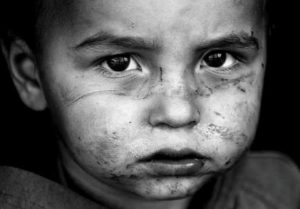 Photo of Abused beaten child