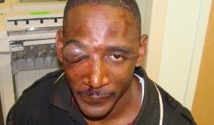 James Holley at the Sheriff's Department after being beaten and falsely arrested