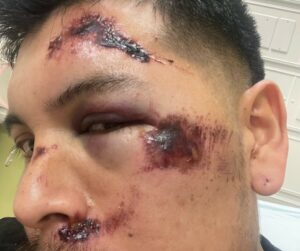 OCAMPO HOSPITAL FACE PHOTO 3