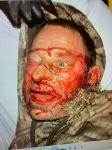 Photo of Ciccarelli taken on ground at scene