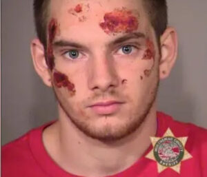mugshot of beaten arrestee